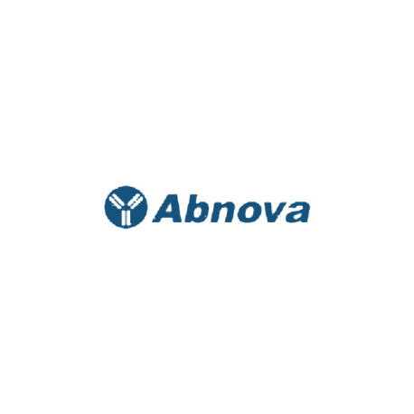 ADAMTS1 (Human) ELISA Kit