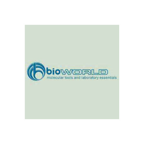 ChIP IP Wash Buffer for Polyclonal Antibody