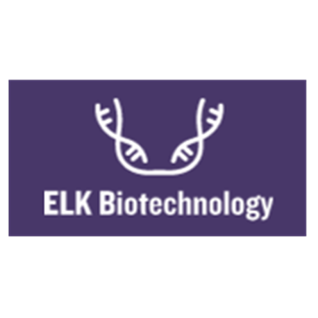 ATM Rabbit Polyclonal Antibody
